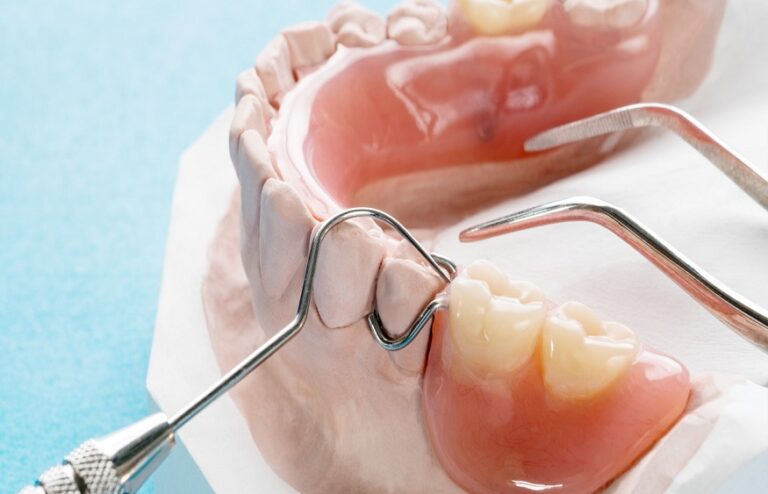 acrylic dentures gold coast