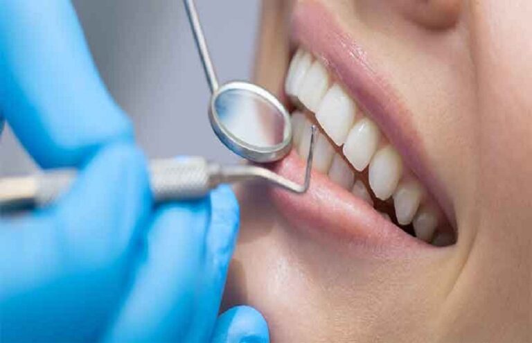 The Need for Dental Checkups