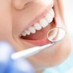 Dental Implants at Dovehouse Dental