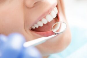 Dental Implants at Dovehouse Dental