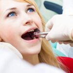 Wisdom Teeth Removal
