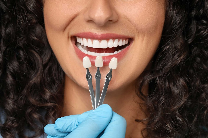 how porcelain veneers improve symmetry and aesthetics